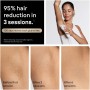Braun Silk-expert Pro 5 PL5221 IPL | Hauks.se